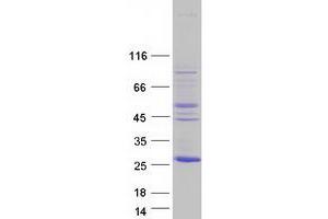 Validation with Western Blot