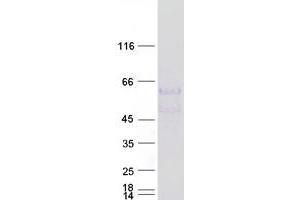 Validation with Western Blot