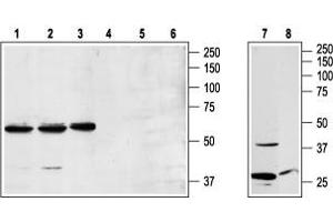 Western blot analysis of Jurkat (lanes 1 and 4), K562 (lanes 2 and 5), and RBL (lanes 3 and 6) cell lysates and rat brain lysates (lanes 7 and 8): - 1,2,3,7. (NPY1R anticorps  (3rd Intracellular Loop))