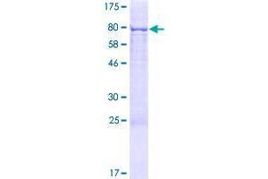 Image no. 1 for Torsin A Interacting Protein 1 (TOR1AIP1) (AA 1-462) protein (GST tag) (ABIN1323361)