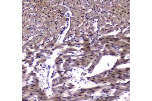IHC analysis of ESRRG using anti-ESRRG antibody .