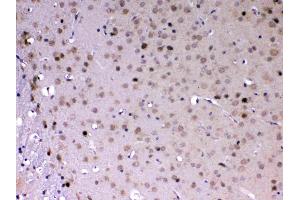 anti-Mediator Complex Subunit 18 (MED18) (AA 1-208) antibody