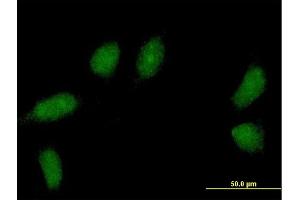 Immunofluorescence of purified MaxPab antibody to C1orf83 on HeLa cell.