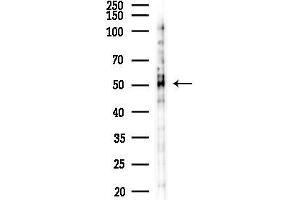 anti-Ribonucleotide Reductase M2 (RRM2) (C-Term) antibody