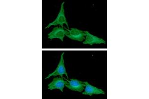 ICC/IF analysis of ATG3 in HeLa cells.