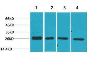 Western Blotting (WB) image for anti-SLUG antibody (ABIN3181521) (SLUG anticorps)