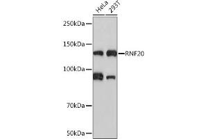 Western blot analysis of extracts of various cell lines, using RNF20 Rabbit mAb (ABIN7270071) at 1:1000 dilution.