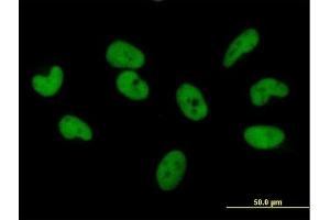 Immunofluorescence of purified MaxPab antibody to ZNF680 on HeLa cell. (ZNF680 anticorps  (AA 1-530))
