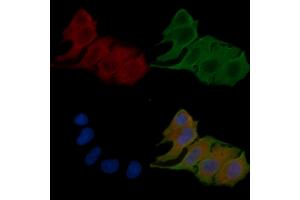 ABIN6257859 and ABIN6275939 staining Hela cells(24h of starvation treatment) by IF/ICC.