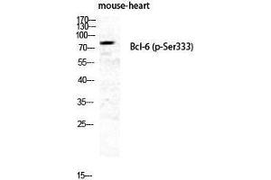 Western Blotting (WB) image for anti-B-Cell CLL/lymphoma 6 (BCL6) (pSer333) antibody (ABIN3173113) (BCL6 anticorps  (pSer333))