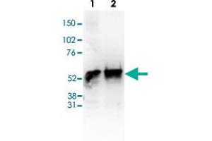 Western Blot (Cell lysate) analysis of (1) 25 ug whole cell extracts of Hela cells, (2) 25 ug nuclear extracts of Hela cells. (HDAC1 anticorps  (C-Term))