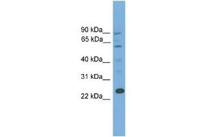 WB Suggested Anti-BCL7A  Antibody Titration: 0. (BCL7A anticorps  (Middle Region))
