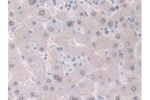 Detection of GDA in Human Liver Tissue using Polyclonal Antibody to Guanine Deaminase (GDA) (GDA anticorps  (AA 1-454))