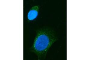 anti-Choroideremia (Rab Escort Protein 1) (CHM) antibody
