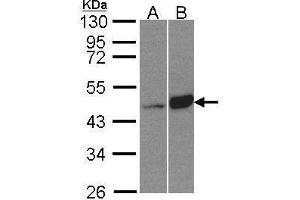 WB Image Sample(30 μg of whole cell lysate) A:HeLa S3, B:Raji, 10% SDS PAGE antibody diluted at 1:500 (BCKDK anticorps)