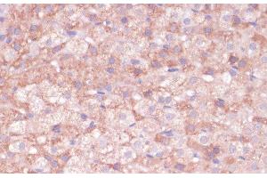 Immunohistochemistry of paraffin-embedded Rat adrenal gland using CYP11B2 Polyclonal Antibody at dilution of 1:100 (40x lens).