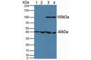 Figure. (PSAT1 anticorps  (AA 1-312))