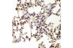 Immunohistochemistry of paraffin-embedded Mouse lung using PPAT antibody at dilution of 1:100 (x400 lens). (PPAT anticorps)