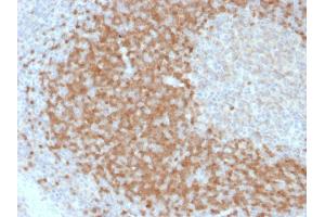 Formalin-fixed, paraffin-embedded human Tonsil stained with TCL1 Mouse Monoclonal Antibody (TCL1/2078).