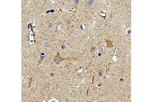 IHC analysis of CD90/Thy1 using anti-CD90/Thy1 antibody (ABIN7600517).