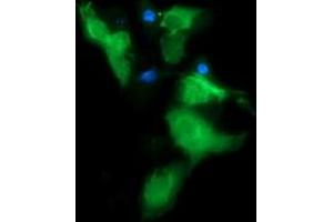 Image no. 7 for anti-Musashi Homolog 2 (MSI2) antibody (ABIN1499578)