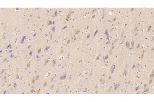 Detection of NT-ProBNP in Human Cerebrum Tissue using Monoclonal Antibody to N-Terminal Pro-Brain Natriuretic Peptide (NT-ProBNP) (NT-ProBNP anticorps)