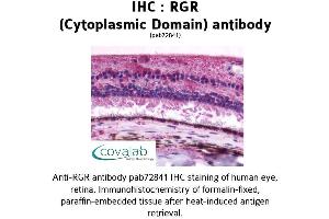 Image no. 1 for anti-Retinal G Protein Coupled Receptor (RGR) (3rd Cytoplasmic Domain) antibody (ABIN1738848) (RGR anticorps  (3rd Cytoplasmic Domain))
