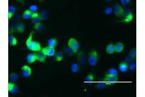 Image no. 10 for anti-Mucin 1 (MUC1) antibody (ABIN1499597) (MUC1 anticorps)