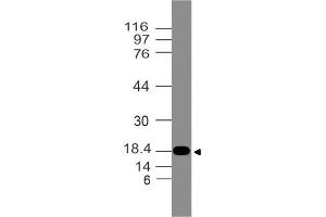 Image no. 1 for anti-Filaggrin Family Member 1 (FLG1) (AA 1-300) antibody (ABIN5027200) (Filaggrin-1 anticorps  (AA 1-300))