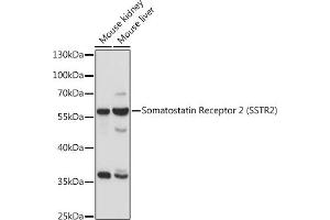 Western blot analysis of extracts of various cell lines, using Somatostatin Receptor 2 (SSTR2) antibody (ABIN7270493) at 1:1000 dilution. (SSTR2 anticorps  (C-Term))