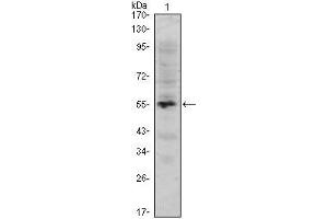 Western Blot showing MUM1 antibody used against human MUM1 (AA: 590-711) recombinant protein. (MUM1 anticorps)