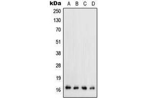 Western blot analysis of TGF alpha expression in HEK293T (A), mouse liver (B), mouse kidney (C), rat kidney (D) whole cell lysates. (TGFA anticorps  (C-Term))