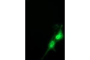 Anti-FAM84B mouse monoclonal antibody (ABIN2453031) immunofluorescent staining of COS7 cells transiently transfected by pCMV6-ENTRY FAM84B (RC207996). (FAM84B anticorps)