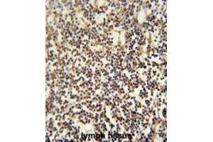 Immunohistochemistry (IHC) image for anti-PARP1 Binding Protein (PARPBP) antibody (ABIN2995516)