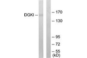 Western blot analysis of extracts from 293 cells, using DGKI Antibody. (DGKI anticorps  (AA 991-1040))