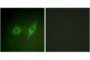 Immunofluorescence analysis of HeLa cells, using Collagen IV alpha2 Antibody. (COL4a2 anticorps  (AA 151-200))