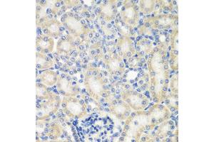 Immunohistochemistry of paraffin-embedded rat kidney using NAA50 antibody. (NAA50 anticorps)