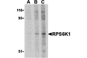 Western Blotting (WB) image for anti-RPS6K1 (C-Term) antibody (ABIN1030629) (RPS6K1 (C-Term) anticorps)