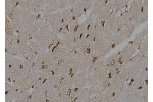 ABIN6276500 at 1/100 staining Mouse heart tissue by IHC-P.