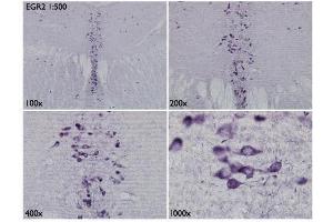 IHC-Fr Image Immunohistochemical analysis of mouse brain tissue (paraformaldehyde-fixed frozen sections), using EGR2, antibody at 1:500 dilution.