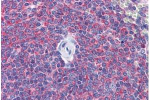 Human Spleen: Formalin-Fixed, Paraffin-Embedded (FFPE) (SNAPIN anticorps  (AA 41-137))