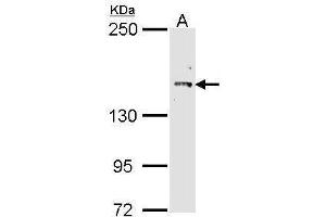 WB Image Sample (30 ug of whole cell lysate) A: Molt-4 , 7.