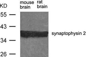 Western blot analysis of extract from rat brain and mouse brain using synaptophysin 2 Antibody. (Synaptoporin anticorps)