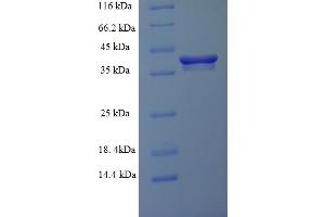 SDS-PAGE (SDS) image for RAB6A, Member RAS Oncogene Family (RAB6A) (AA 2-208) protein (His-SUMO Tag) (ABIN5710211)