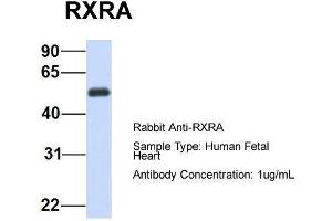 Host:  Rabbit  Target Name:  RXRA  Sample Type:  Human Fetal Heart  Antibody Dilution:  1. (Retinoid X Receptor alpha anticorps  (N-Term))