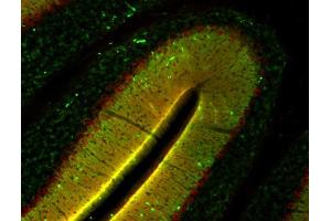 Indirect immunolabeling of mouse cerebellum section with anti-homer 3 (dilution 1 : 500; red) and anti-synapsin (, dilution 1 : 500; green). (HOMER3 anticorps  (AA 1-177))