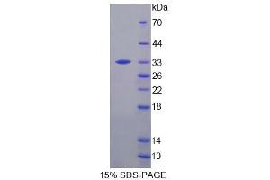 SDS-PAGE (SDS) image for 2',3'-Cyclic Nucleotide 3' phosphodiesterase (CNP) (AA 110-365) protein (His tag) (ABIN6239156)