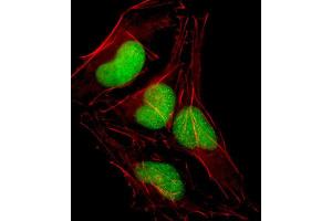 Immunofluorescence (IF) image for anti-SRY (Sex Determining Region Y)-Box 18 (SOX18) antibody (ABIN2998551)