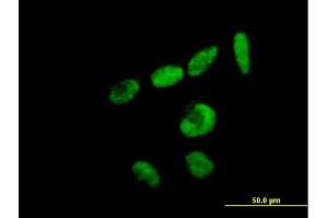 Immunofluorescence of purified MaxPab antibody to RBM15 on HeLa cell. (RBM15 anticorps  (AA 1-544))