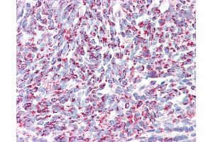 Anti-PRDX3 / Peroxiredoxin 3 antibody IHC of human tonsil.